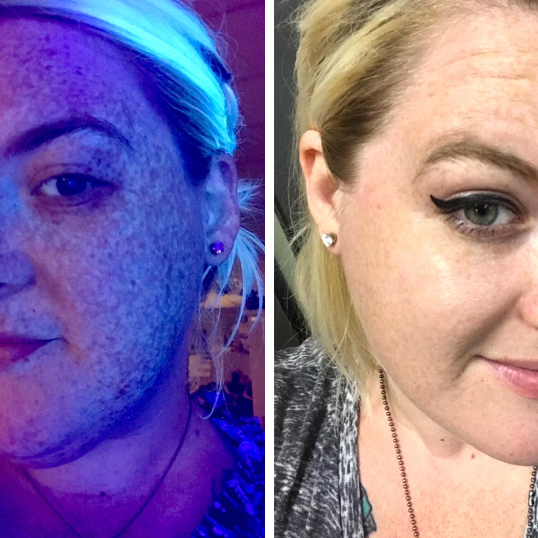 Jackboy freckle detection application